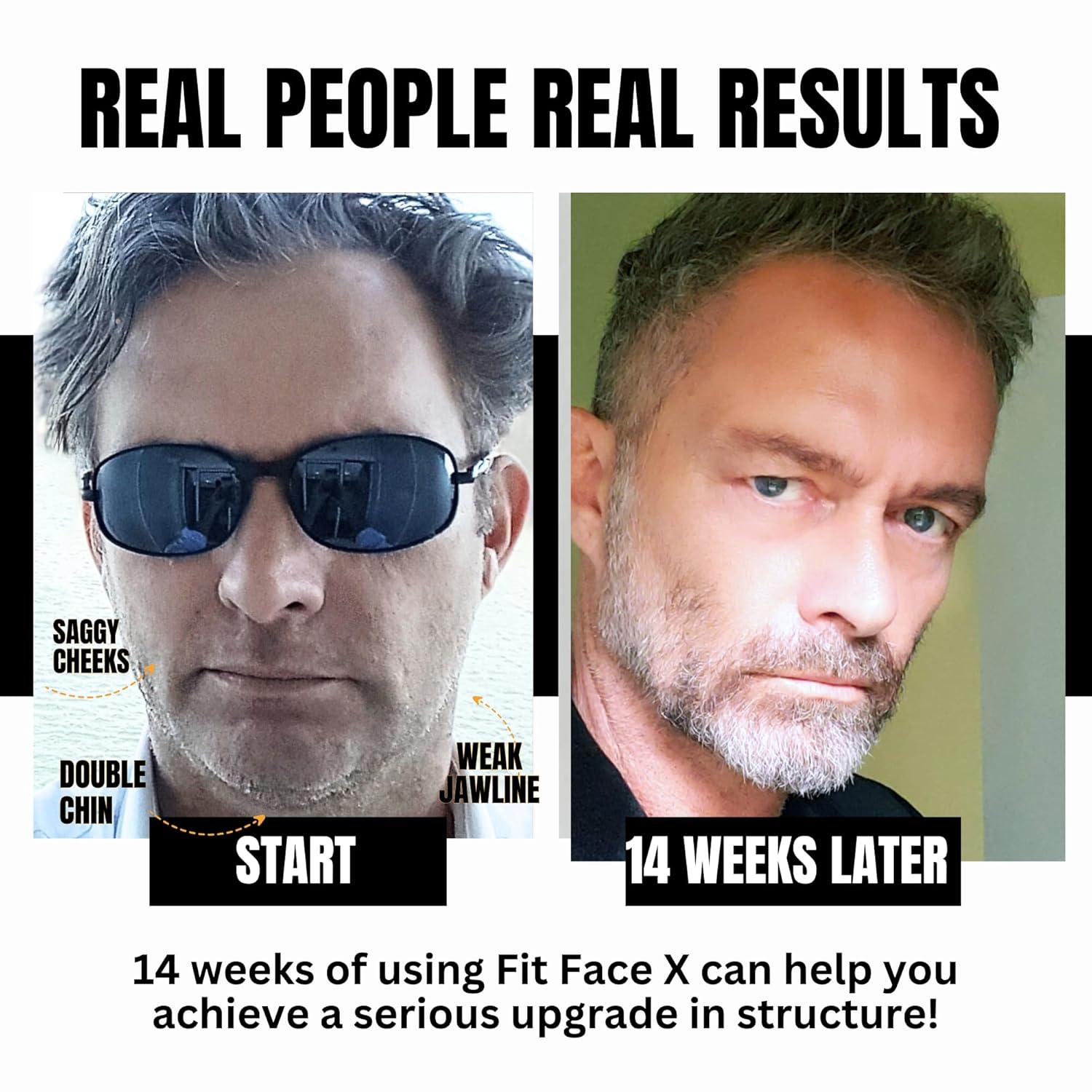 81ammZX5vML._SL1500_.jpg WORLDS FIRST FACE SCULPTING GYM -4 Tools Working Out Over 60 Face Muscles/Face Lift In a Box/Fully Sculpt Your Cheeks, Neck, Jowls, Jawline, lips, Chin & Neck. NEVER-SKIP-FACE-DAY - Image 6